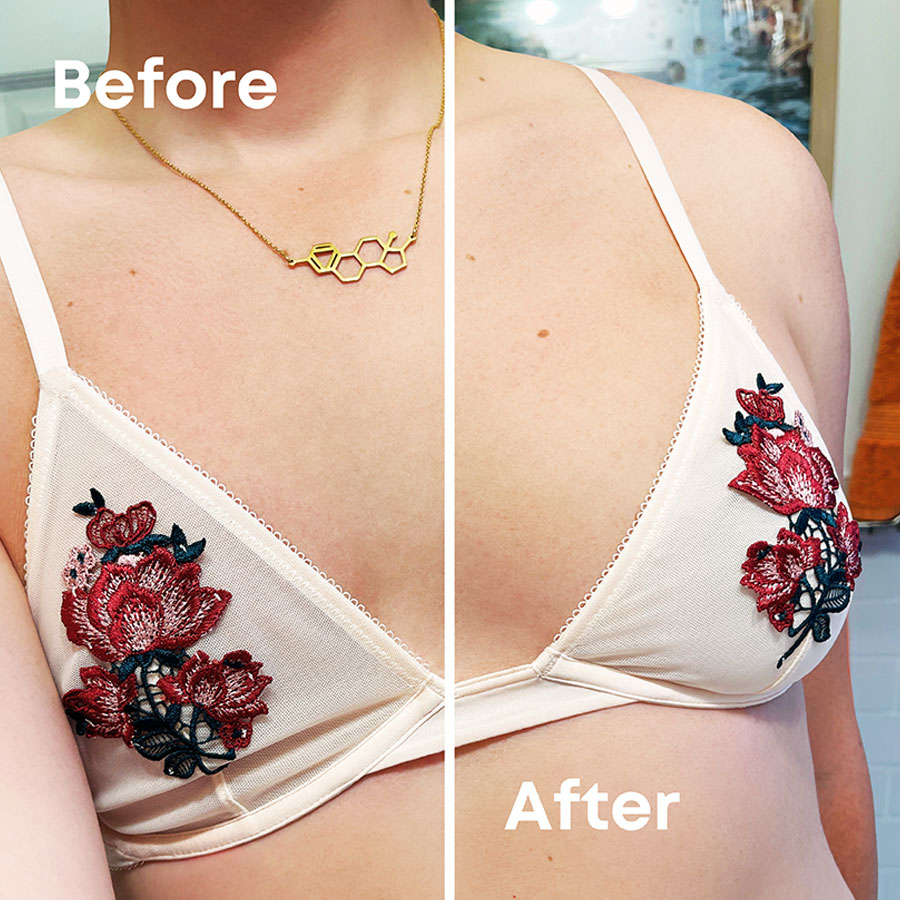 Unclockable Bra Buds™ aus Silikon haben Implantatqualität – Diese BH-Einlagen aus medizinischem Silikon sind weich, formbeständig, geruchlos, hypoallergen, latexfrei und komfortabel.